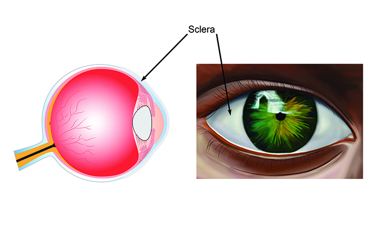 Image showing the front and side view of the sclera